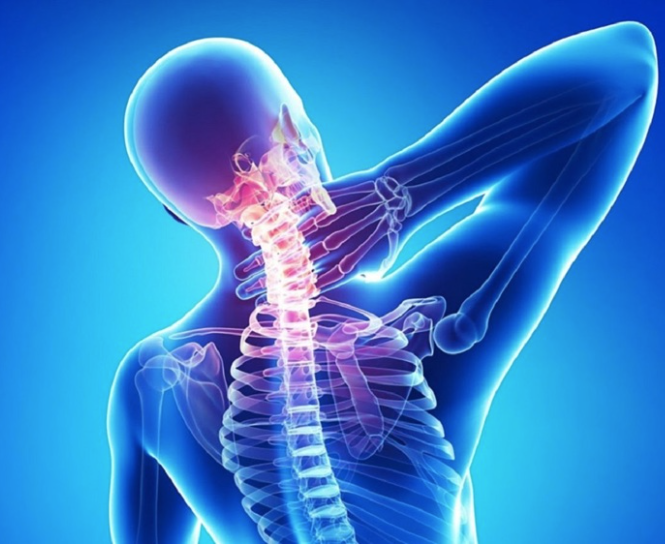 Chụp cộng hưởng từ cột sống cổ